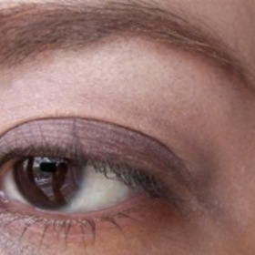 cornea problem continues.