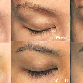 My results with Latisse. Very pleased!