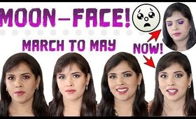 MOON FACE or CUSHING'S SYNDROME: How YOU Helped Me Cope With Symptoms