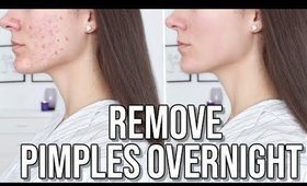 How To Get Rid Of Pimples OVERNIGHT !
