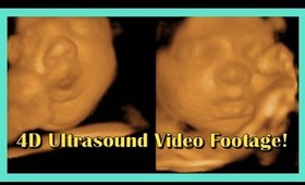 4D Ultrasound Video Footage!