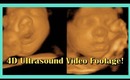4D Ultrasound Video Footage!