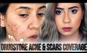 CHIT CHAT // DRUGSTORE ACNE FOUNDATION ROUTINE - COVER ACNE AND SCARS