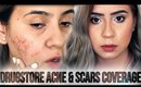 CHIT CHAT // DRUGSTORE ACNE FOUNDATION ROUTINE - COVER ACNE AND SCARS