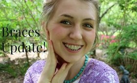 Braces Update!  Quick Tip Tuesday