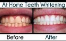 Smile Brilliant At Home Teeth Whitening!