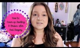 How to: Covering Up Swelling & Bruises from Oral Surgery