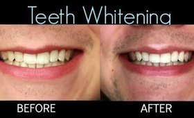 How to Get Whiter Teeth at Home! + Giveaway