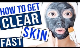 HOW TO: Get Clear Skin FAST!