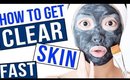 HOW TO: Get Clear Skin FAST!