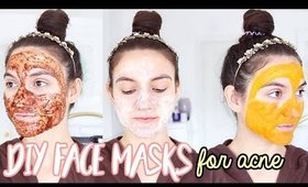 4 DIY Face Masks For ACNE | How To Get Rid Of Pimples OVERNIGHT