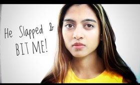 Rape Alert - He BIT MY FACE! _  Smile With Prachi #65