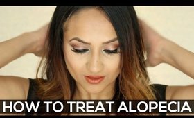 How to Treat Alopecia Areata