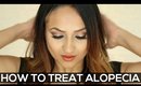 How to Treat Alopecia Areata
