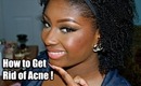 How I got rid of my Acne!