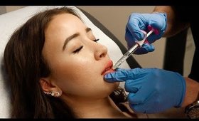 GETTING LIP FILLERS | My Experience With Injections
