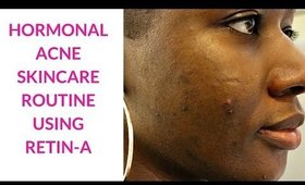 My Hormonal Acne Skincare Routine Using Retin-A