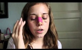 ♡ Nose Job Vlog: Part 2 ♡
