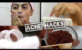 Acne - 5 Acne Hacks & How to Treat Acne Prone Skin | 5 Face Wash Tips