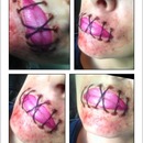 Sewn up mouth 