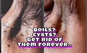 Boils Under Armpits & Inner Thighs