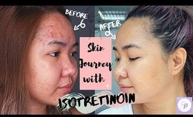 SKIN JOURNEY l ISOTRETINOIN (ACCUTANE) EXPERIENCE l BEFORE AND AFTER VIDEOS
