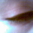 Eyes