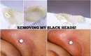 How I remove my Black heads - Update Queenii Rozenblad