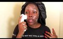 Skin Care Tips | Clear Skin Routine│Tamekans
