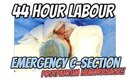 My 44 Hour Labour & C-Section Delivery Story