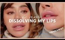 DISSOLVING MY LIP FILLERS AFTER 5 YEARS