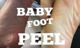 TRYING BABY FOOT!! Foot Peel Demo + RESULTS