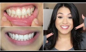 HOW TO WHITEN TEETH AT HOME