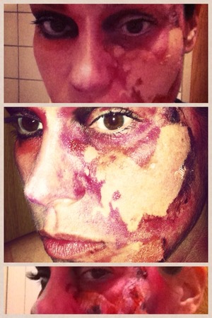 burned face at Halloween 