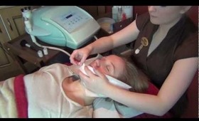 CACI Chroma Clear (Microdermabrasion)