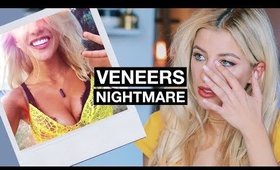 My Horrific Experience With Veneers | The Truth