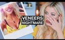 My Horrific Experience With Veneers | The Truth