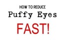 How to Reduce Puffy Eyes Fast