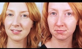 How To Hide Acne! - Flawless Foundation Routine