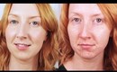 How To Hide Acne! - Flawless Foundation Routine