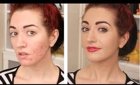 How To Cover Acne & Scarring • My Full Coverage Foundation Routine