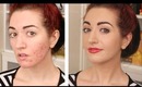 How To Cover Acne & Scarring • My Full Coverage Foundation Routine