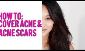 How To: Cover Blemishes & Acne Scars