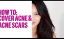 How To: Cover Blemishes & Acne Scars