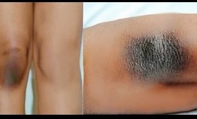 Hindi DIY #1 - How to Lighten Dark Knees and Elbows Naturally At Home | Skin Whitening