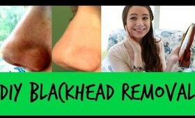 DIY How To Remove Blackheads! (2 Simple Ways)