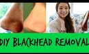 DIY How To Remove Blackheads! (2 Simple Ways)