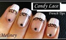 CANDY LACE FRENCH TIP NAIL ART DESIGN | NAIL TUTORIAL MANICURE FOR BEGINNERS HOME MADE EASY