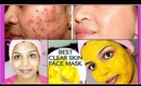 Best Acne Treatment Get Rid Of Acne Fast Naturally, How to Get Flawless skin,Treat Acne Scars