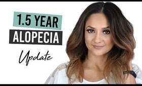 1.5 Year Alopecia Areata Update